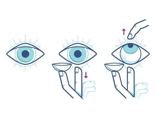 ilustrace nasazení čočky: v levé části oko, uprostřed držení čočky ACUVUE® na prstu před okem a v pravé části stáhnutí dolního víčka pomocí dalších prstů