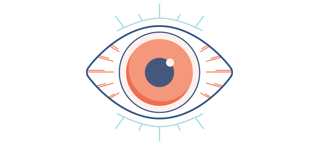 ilustrace červeného oka se zarudlým bělmem